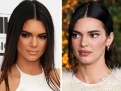 Кендал Џенер ги демантира гласините за операција: „Носот ми се промени од лекови против акни“