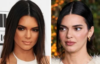 Кендал Џенер ги демантира гласините за операција: „Носот ми се промени од лекови против акни“